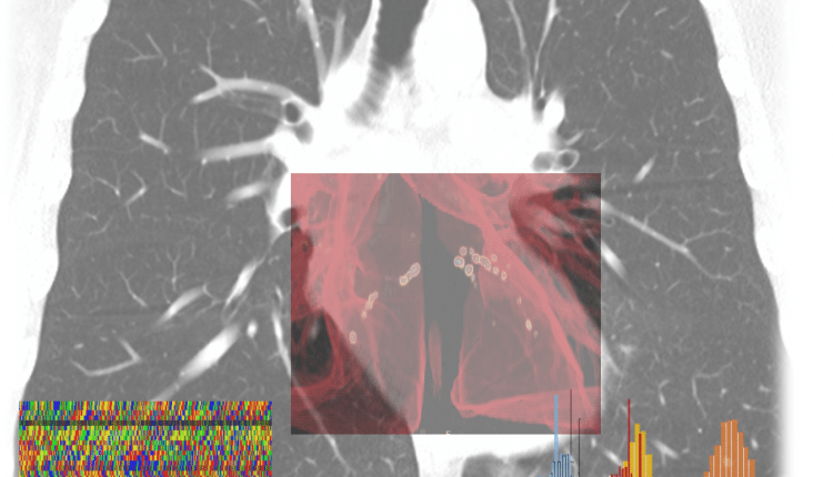 milano trapianto 18enne