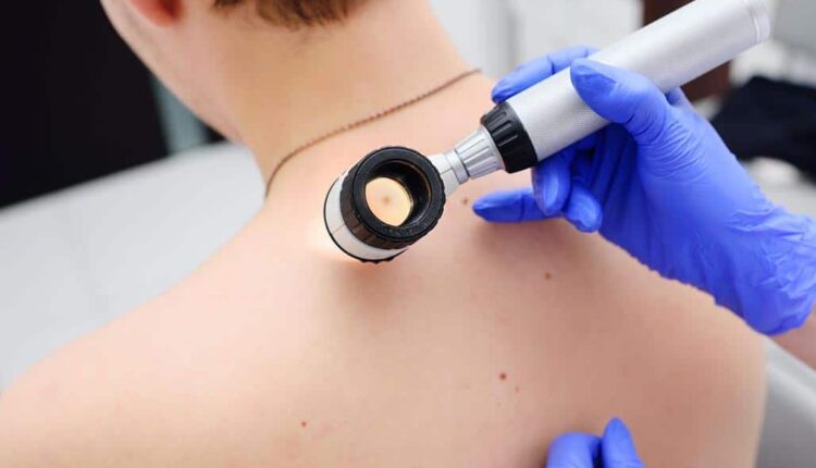 Visita dermatologica a Milano: come prenotare e perché è importante