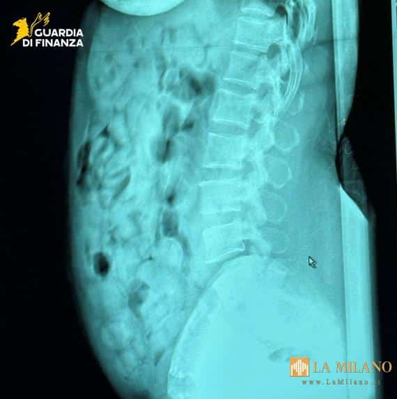 Bergamo, arrestata a Orio al Serio passeggera con 120 ovuli di eroina ingeriti