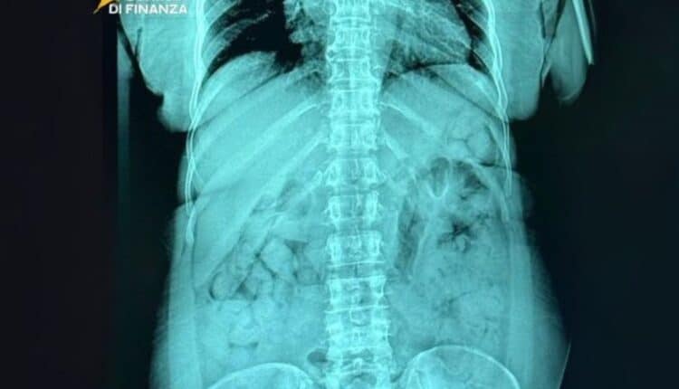 Bergamo, arrestata a Orio al Serio passeggera con 120 ovuli di eroina ingeriti